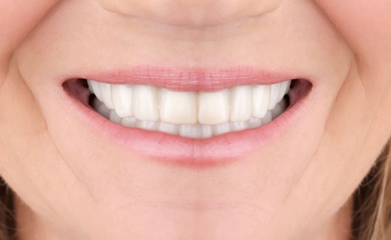 After dental implant treatment