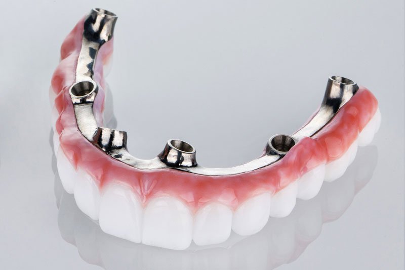 Full Zirconia Bridge dental service